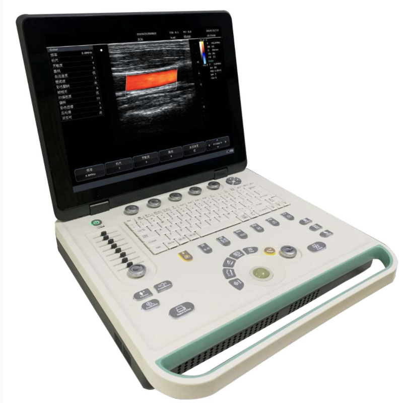 祥宸c5笔记本彩色多普勒超声诊断仪LCD显示器多波束合成