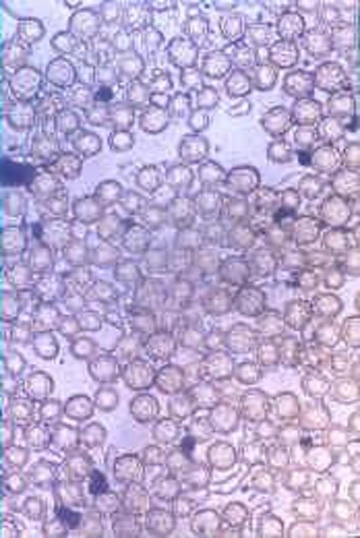 米根霉孢子形态图片