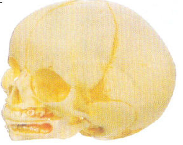 GD/A11115婴儿头颅骨模型（2部分，进口pvc材料）