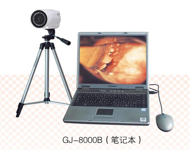 数码电子阴道镜（笔记本）GJ-8000B 型